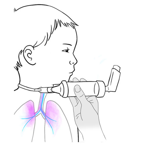 529.metered dose inhaler vapor in lungs.FINAL